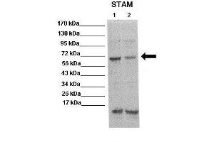 WB Suggested Anti-STAM Antibody  Positive Control: Lane 1: 20ug mouse brain extract Lane 2: 20ug mouse brain extract Primary Antibody Dilution :  1:500 Secondary Antibody : Anti rabbit-HRP  Secondry Antibody Dilution :  1:5,000 Submitted by: Scott Wilson, University of Alabama at Birmingham (STAM Antikörper  (N-Term))