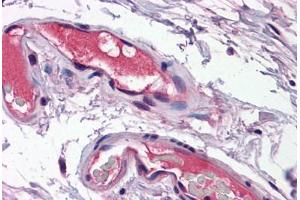 Human Vessels: Formalin-Fixed, Paraffin-Embedded (FFPE) (Osteopontin Antikörper  (N-Term))