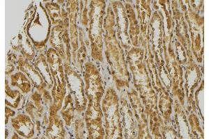 ABIN6278470 at 1/100 staining Mouse kidney tissue by IHC-P.