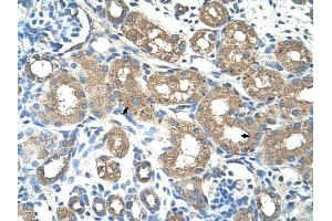 ALAS2 antibody was used for immunohistochemistry at a concentration of 4-8 ug/ml to stain Epithelial cells of renal tubule (arrows) in Human Kidney. (ALAS2 Antikörper)