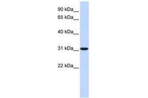 Image no. 1 for anti-Carbonic Anhydrase VIII (CA8) (C-Term) antibody (ABIN6740749) (CA8 Antikörper  (C-Term))