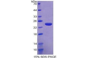 SDS-PAGE (SDS) image for Contactin Associated Protein-Like 4 (CNTNAP4) (AA 706-886) protein (His tag) (ABIN2124495)