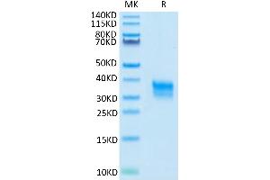 Cynomolgus Fc gamma RIIA on Tris-Bis PAGE under reduced condition. (FCGR2A Protein (AA 28-208) (His tag))