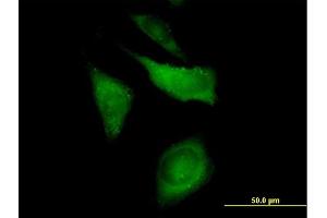 Immunofluorescence of purified MaxPab antibody to CAP1 on HeLa cell. (CAP1 Antikörper  (AA 1-475))