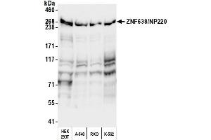 Western Blotting (WB) image for anti-Zinc Finger Protein 638 (ZNF638) (AA 225-275) antibody (ABIN7539900) (ZNF638 Antikörper  (AA 225-275))