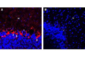 Expression of GABA Transporter 1 in mouse cerebellum.