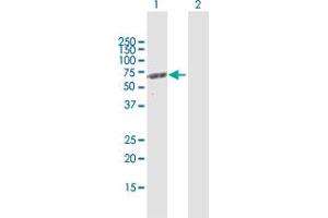 Western Blotting (WB) image for anti-Methylcrotonoyl-CoA Carboxylase 2 (Beta) (MCCC2) (AA 1-563) antibody (ABIN949576)
