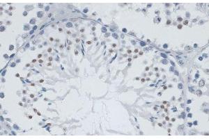 Immunohistochemistry of paraffin-embedded Mouse testis using MSH6 Polyclonal Antibody at dilution of 1:100 (40x lens). (MSH6 Antikörper)
