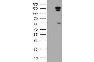 Western Blotting (WB) image for anti-ATP/GTP Binding Protein 1 (AGTPBP1) (AA 368-753) antibody (ABIN1491462) (AGTPBP1 Antikörper  (AA 368-753))