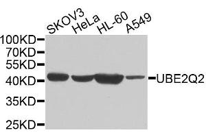 Western blot analysis of extracts of various cell lines, using UBE2Q2 antibody. (UBE2Q2 Antikörper  (AA 1-150))