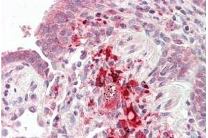 Human Lung, macrophages: Formalin-Fixed, Paraffin-Embedded (FFPE) (TRIM72 Antikörper  (AA 108-157))
