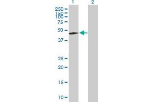 Western Blot analysis of KRT32 expression in transfected 293T cell line by KRT32 MaxPab polyclonal antibody.