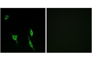 Immunofluorescence (IF) image for anti-Deleted in Colorectal Carcinoma (DCC) (AA 441-490) antibody (ABIN2889985) (DCC Antikörper  (AA 441-490))