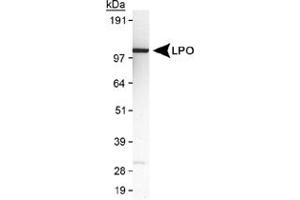 Western blot analysis of LPO in MDA-MB-231 cell lysate using LPO polyclonal antibody . (LPO Antikörper  (AA 300-400))