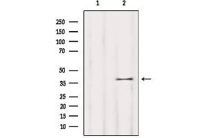 Western blot analysis of extracts from Mouse brain, using OR5T1 Antibody. (OR5T1 Antikörper)