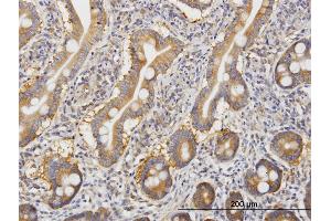 Immunoperoxidase of monoclonal antibody to ROCK2 on formalin-fixed paraffin-embedded human small Intestine.