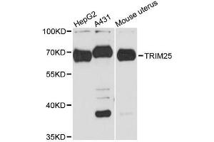 Western blot analysis of extracts of various cell lines, using TRIM25 antibody. (TRIM25 Antikörper  (AA 100-400))