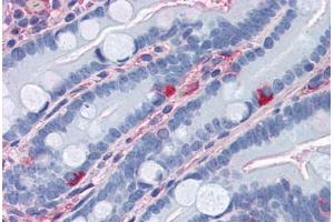 Human Small Intestine (formalin-fixed, paraffin-embedded) stained with APOA1 antibody ABIN364438 at 10 ug/ml followed by biotinylated anti-mouse IgG secondary antibody ABIN481714, alkaline phosphatase-streptavidin and chromogen. (APOA1 Antikörper)