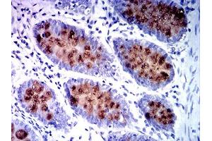 Immunohistochemistry (IHC) image for anti-Mucin 2, Oligomeric Mucus/gel-Forming (MUC2) (AA 4373-4557) antibody (ABIN7193601)