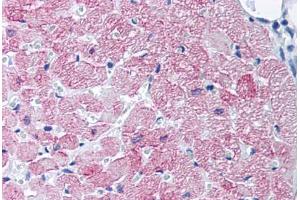 Human Heart, Cardiac Myocytes (formalin-fixed, paraffin-embedded) stained with SLC2A4 antibody ABIN218433 at 10-20 ug/ml followed by biotinylated goat anti-rabbit IgG secondary antibody ABIN481713, alkaline phosphatase-streptavidin and chromogen. (GLUT4 Antikörper)
