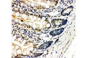 Anti-NFkB p100/p52 antibody, IHC(P) IHC(P): Rat Intestine Tissue