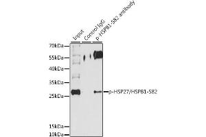 Immunoprecipitation (IP) image for anti-Heat Shock 27kDa Protein 1 (HSPB1) (pSer82) antibody (ABIN3023550)