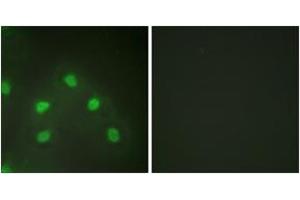 Immunofluorescence analysis of HeLa cells, using hnRNP L Antibody. (HNRNPL Antikörper  (AA 61-110))