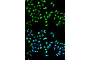 Immunofluorescence analysis of HeLa cell using GALNT2 antibody. (GALNT2 Antikörper)