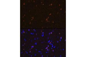 Immunofluorescence analysis of rat brain using NMD Rabbit mAb (ABIN7267417) at dilution of 1:100 (40x lens). (GRIN1/NMDAR1 Antikörper)