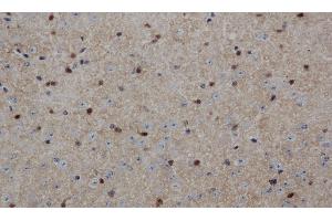 Immunohistochemistry of paraffin-embedded Mouse brain using ENO1 Polyclonal Antibody at dilution of 1:50 (ENO1 Antikörper)