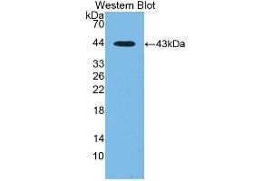 Detection of Recombinant CTBS, Human using Polyclonal Antibody to Di-N-Acetyl Chitobiase (CTBS)