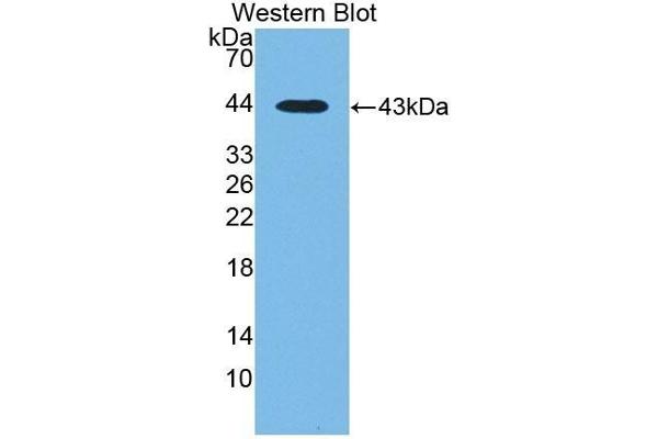CTBS Antikörper  (AA 47-385)