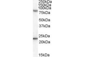 ABIN263162 (0. (DHX58 Antikörper  (C-Term))