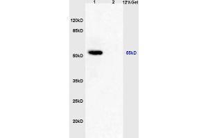 Lane 1: rat brain lysates Lane 2: rat liver lysates probed with Anti phospho-CAMK4(Thr196 + Thr200) Polyclonal Antibody, Unconjugated (ABIN720550) at 1:200 in 4 °C. (CAMK4 Antikörper  (pThr196, pThr200))