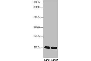 Western Blot All lanes: CABP5 antibody at 12 μg/mL Lane 1: Mouse kidney tissue Lane 2: Mouse thymus tissue Secondary Goat polyclonal to rabbit IgG at 1/10000 dilution Predicted band size: 20 kDa Observed band size: 20 kDa (CABP5 Antikörper  (AA 1-173))