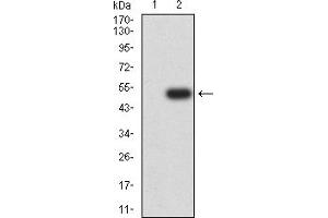 Western Blotting (WB) image for anti-SET Domain Containing 2 (SETD2) (AA 2054-2245) antibody (ABIN7193416)