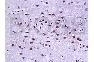 Formalin-fixed and paraffin embedded rat brain tissue labled with Anti-LAMR1(CT) Polyclonal Antibody, Unconjugated (ABIN729598) at 1:200, followed by conjugation to the secondary antibody and DAB staining (LAMR1CT (AA 201-295) Antikörper)