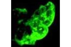 Immunofluorescence staining of methanol-fixed NTERA-2 cl. (TRA1-81 Antikörper)