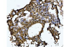 IHC analysis of PSMB4 using anti-PSMB4 antibody (ABIN7600532).