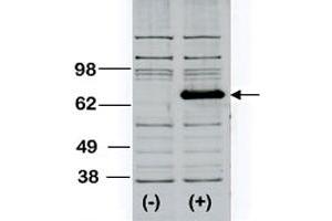 Western blot analysis of BTK polyclonal antibody  transiently transfected HEK293 cell line lysate (1 ug/lane).