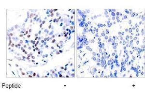 Image no. 1 for anti-Jun Proto-Oncogene (JUN) (Thr239) antibody (ABIN197134) (C-JUN Antikörper  (Thr239))