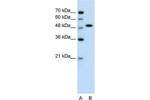 Western Blotting (WB) image for anti-SRY (Sex Determining Region Y)-Box 11 (SOX11) antibody (ABIN2461679) (SOX11 Antikörper)