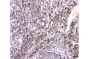 IHC analysis of HECTD3 using anti-HECTD3 antibody (ABIN6719595). (HECTD3 Antikörper)