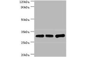 Western blot All lanes: HNRNPA0 antibody at 12 μg/mL Lane 1: Mouse brain tissue Lane 2: Hela whole cell lysate Lane 3: Jurkat whole cell lysate Secondary Goat polyclonal to rabbit IgG at 1/10000 dilution Predicted band size: 31 kDa Observed band size: 31 kDa (HNRNPA (AA 1-180) Antikörper)
