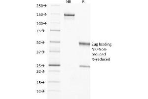 SDS-PAGE Analysis Purified TIMP2 Mouse Monoclonal Antibody (3A4). (TIMP2 Antikörper  (N-Term))