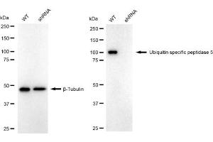 Western blotting analysis using Ubiquitin specific peptidase 5 antibody (ABIN7800737).
