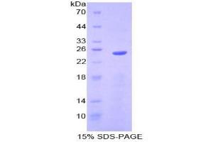 SDS-PAGE analysis of Mouse Sprouty Homolog 2 Protein. (SPRY2 Protein)