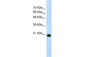 Western Blotting (WB) image for anti-F-Box Protein 25 (FBXO25) antibody (ABIN2462666) (FBXO25 Antikörper)