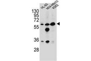 western blot analysis of Glycine amidinotransferase antibody (N-term) in HL-60,MDA-MB453,K562 cell line lysates (35ug/lane). (GATM Antikörper  (N-Term))