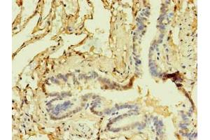 Immunohistochemistry (IHC) image for anti-CD14 (CD14) antibody (ABIN7140933)